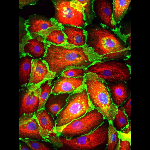 mammary epithelial cell