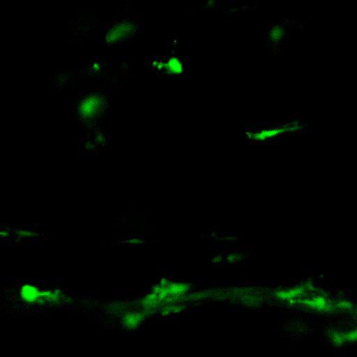 MC38-Cerulean cancer cells