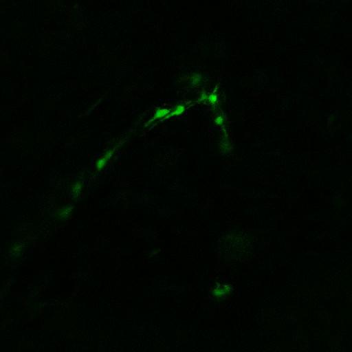 MC57-Cerulean cancer cells