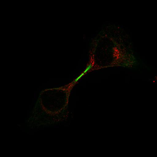 epithelial cell