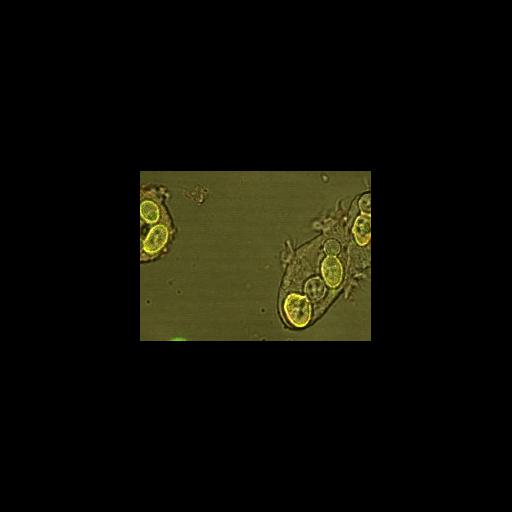 amoeboid cell