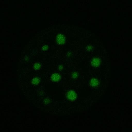 nuclear chromatin