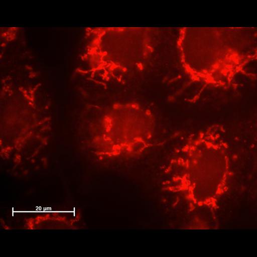 permanent cell line cell