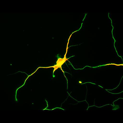 multipolar neuron