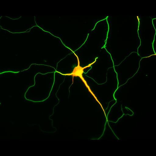 multipolar neuron