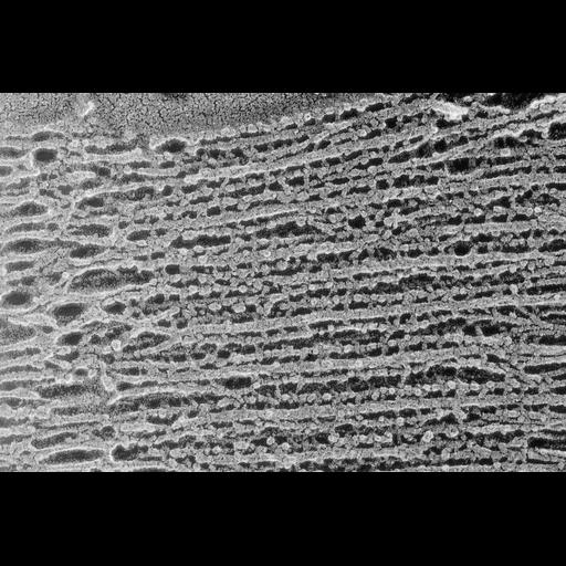 skeletal muscle cell