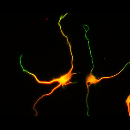 multipolar neuron