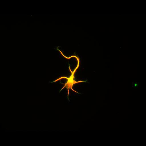 multipolar neuron